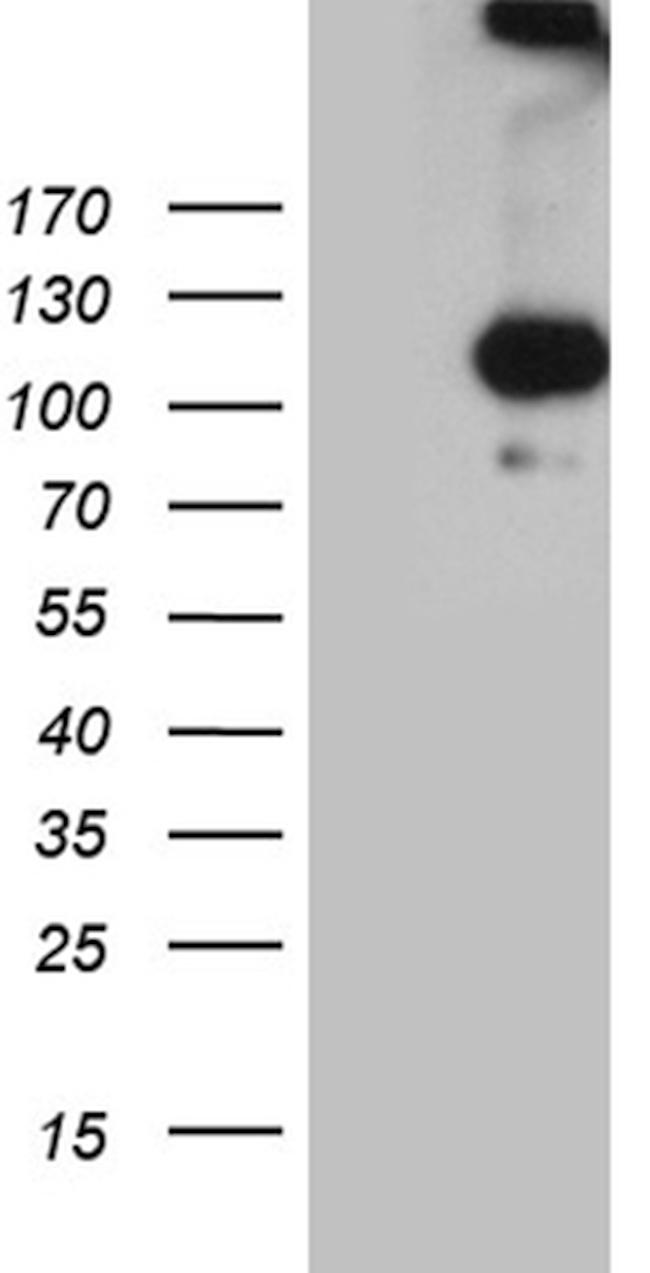 IL20RA Antibody in Western Blot (WB)