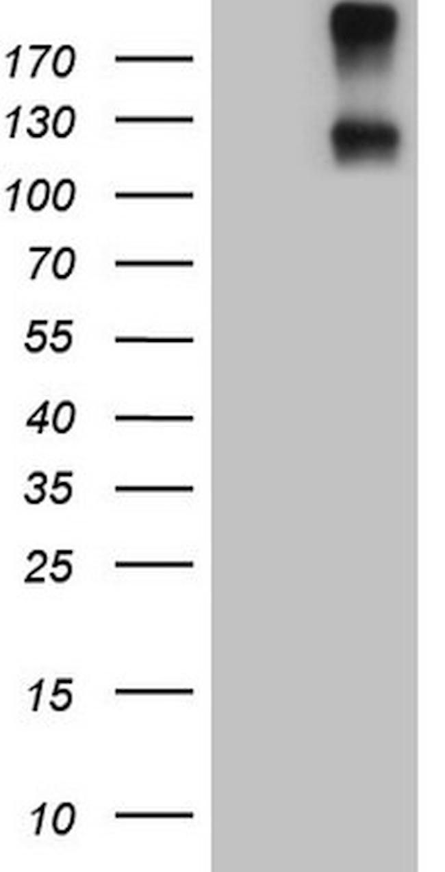 IL23R Antibody in Western Blot (WB)