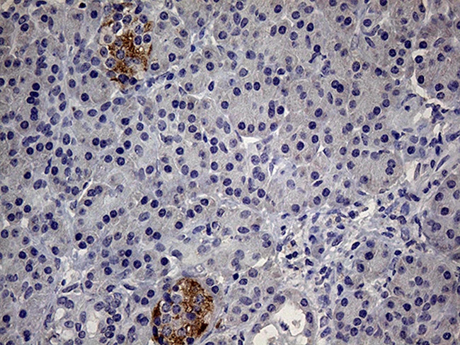 IL24 Antibody in Immunohistochemistry (Paraffin) (IHC (P))