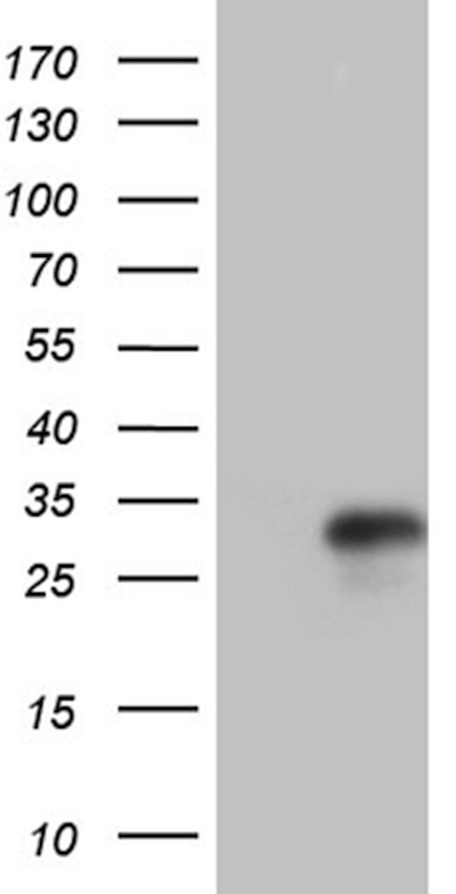 IL24 Antibody in Western Blot (WB)