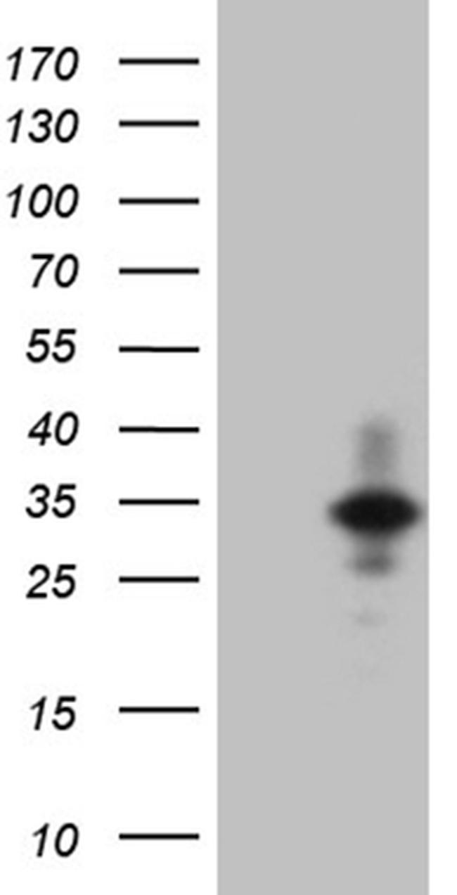 IL24 Antibody in Western Blot (WB)