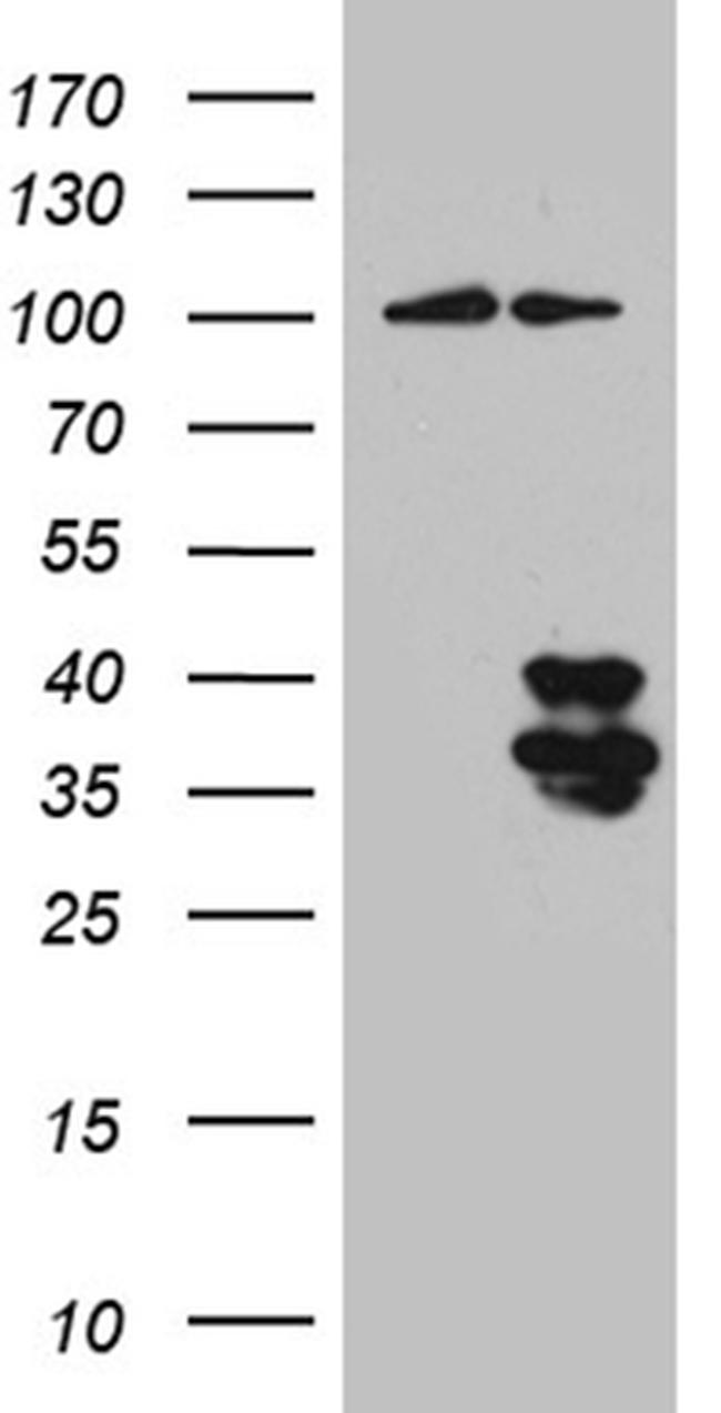 IL34 Antibody in Western Blot (WB)