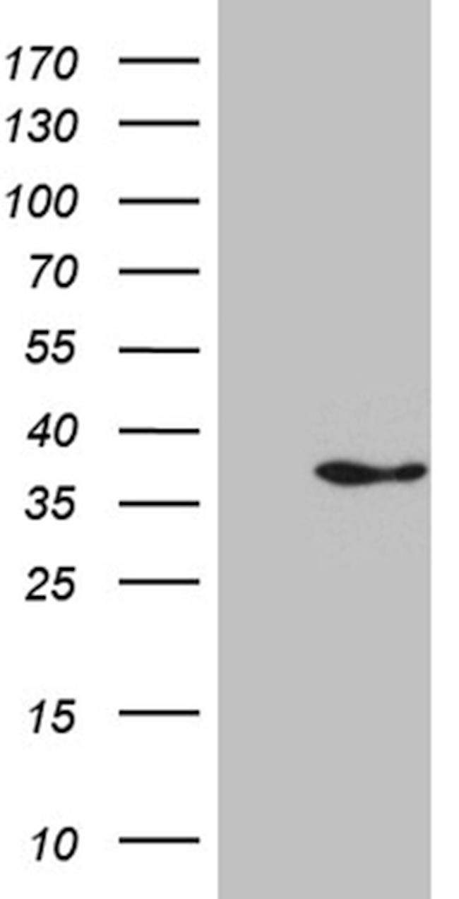 IL34 Antibody in Western Blot (WB)