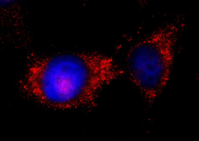 ILK Antibody in Immunocytochemistry (ICC/IF)