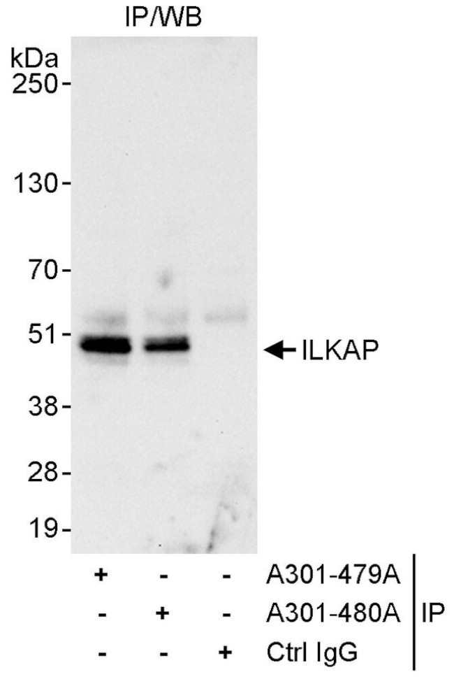 ILKAP Antibody in Immunoprecipitation (IP)