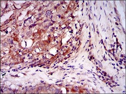 ILK Antibody in Immunohistochemistry (Paraffin) (IHC (P))