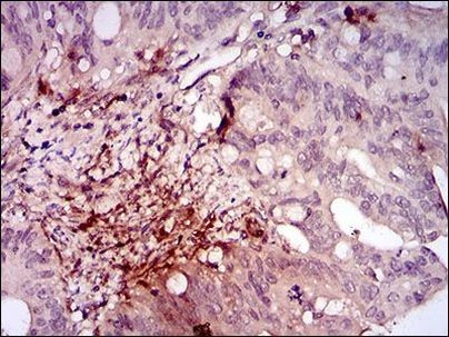 ILK Antibody in Immunohistochemistry (Paraffin) (IHC (P))