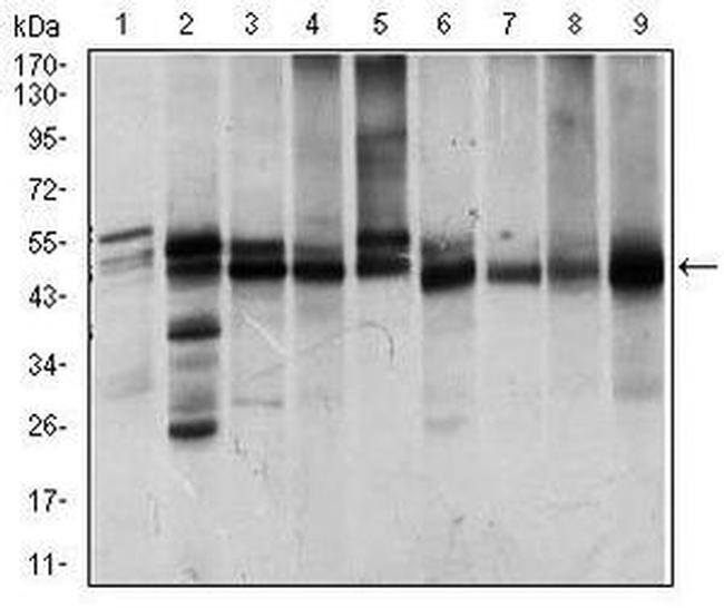 ILK Antibody in Western Blot (WB)