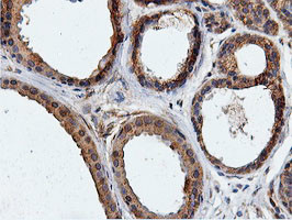 ILVBL Antibody in Immunohistochemistry (Paraffin) (IHC (P))