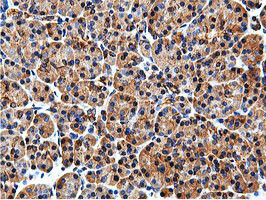 ILVBL Antibody in Immunohistochemistry (Paraffin) (IHC (P))