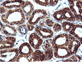 ILVBL Antibody in Immunohistochemistry (Paraffin) (IHC (P))