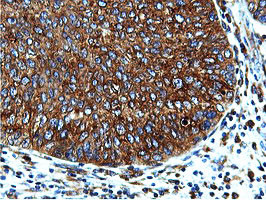 ILVBL Antibody in Immunohistochemistry (Paraffin) (IHC (P))