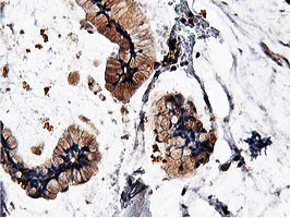 ILVBL Antibody in Immunohistochemistry (Paraffin) (IHC (P))