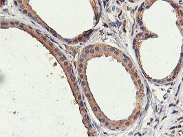 ILVBL Antibody in Immunohistochemistry (Paraffin) (IHC (P))