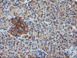 ILVBL Antibody in Immunohistochemistry (Paraffin) (IHC (P))