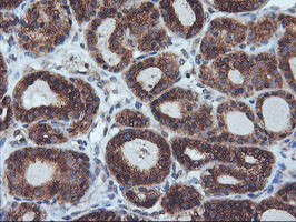 ILVBL Antibody in Immunohistochemistry (Paraffin) (IHC (P))