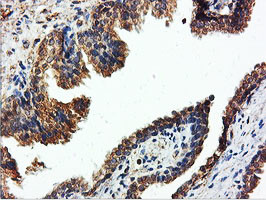 ILVBL Antibody in Immunohistochemistry (Paraffin) (IHC (P))