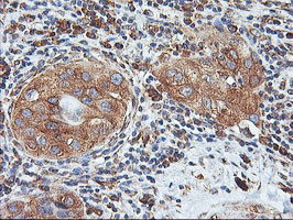 ILVBL Antibody in Immunohistochemistry (Paraffin) (IHC (P))