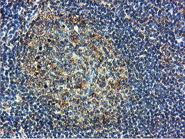 ILVBL Antibody in Immunohistochemistry (Paraffin) (IHC (P))