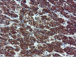 ILVBL Antibody in Immunohistochemistry (Paraffin) (IHC (P))