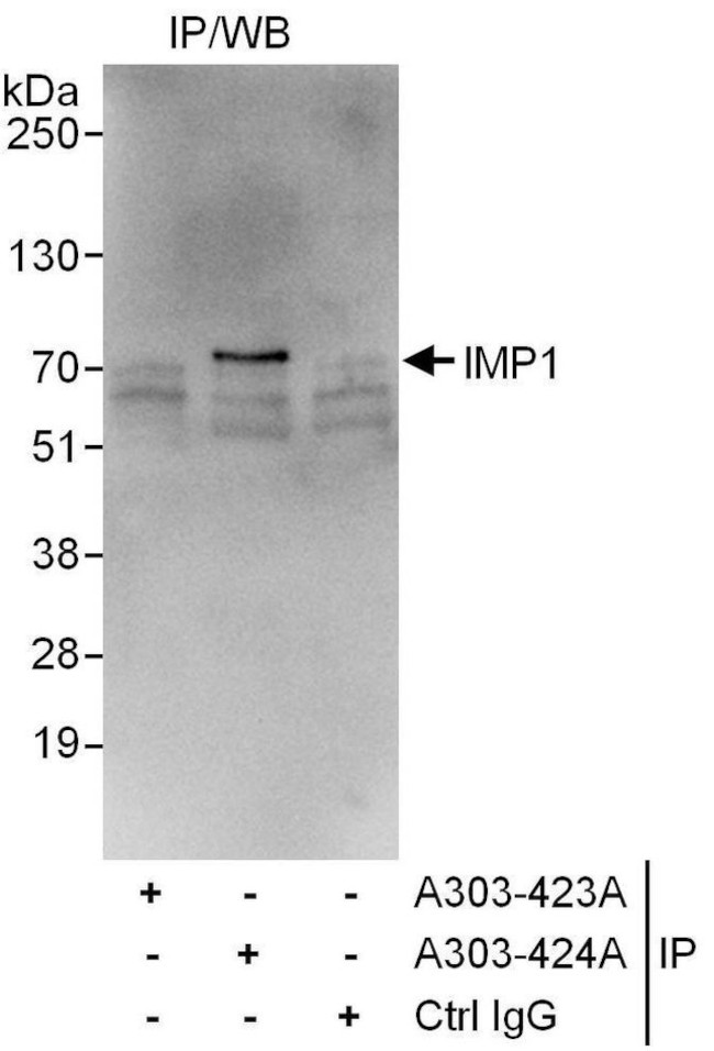 IMP1 Antibody in Immunoprecipitation (IP)