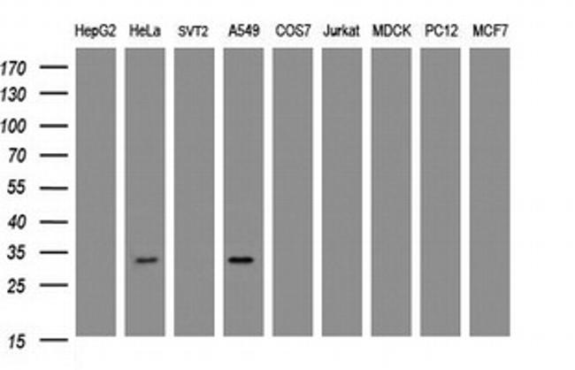 ING2 Antibody in Western Blot (WB)