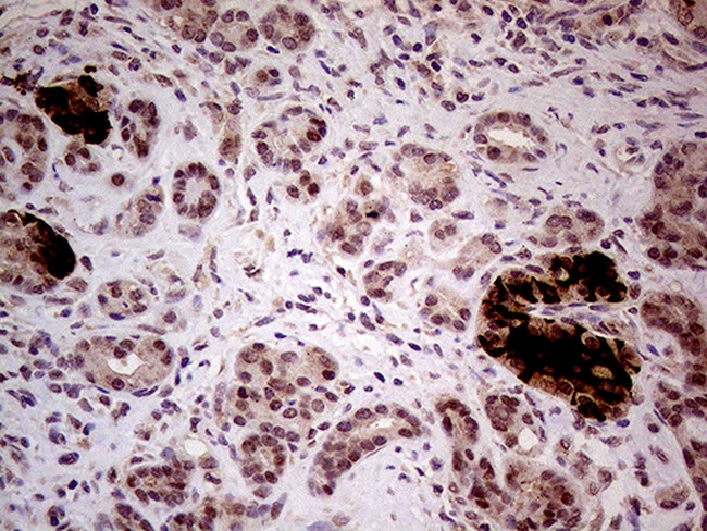 INPP5F Antibody in Immunohistochemistry (Paraffin) (IHC (P))