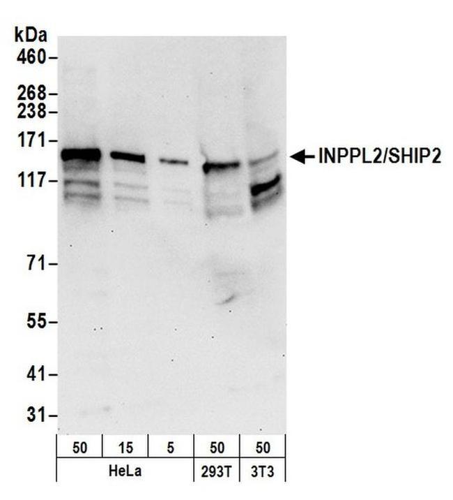 INPPL1/SHIP2 Antibody in Western Blot (WB)