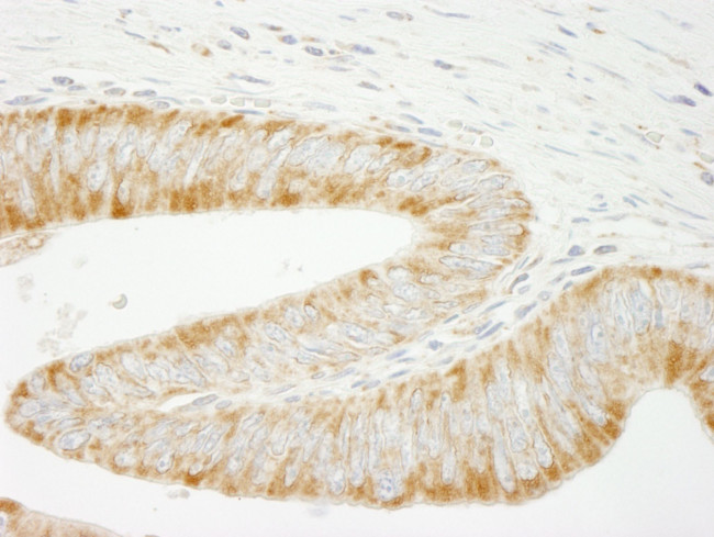 INPPL1/SHIP2 Antibody in Immunohistochemistry (IHC)