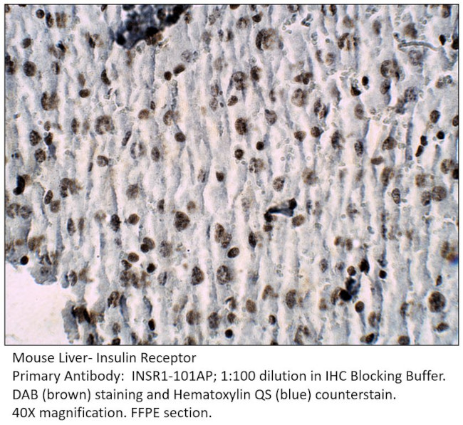 Insulin Receptor Antibody in Immunohistochemistry (IHC)