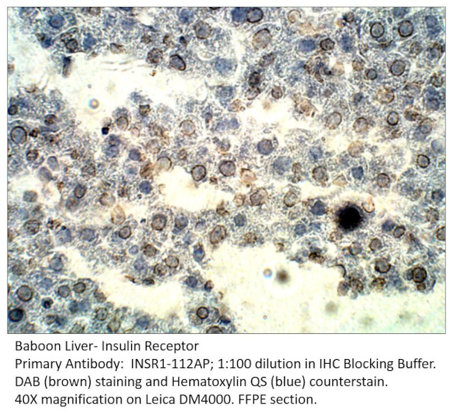 Insulin Receptor Antibody in Immunohistochemistry (IHC)