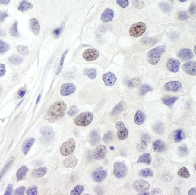 INT8 Antibody in Immunohistochemistry (IHC)