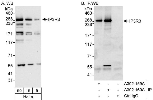 IP3R3 Antibody in Western Blot (WB)