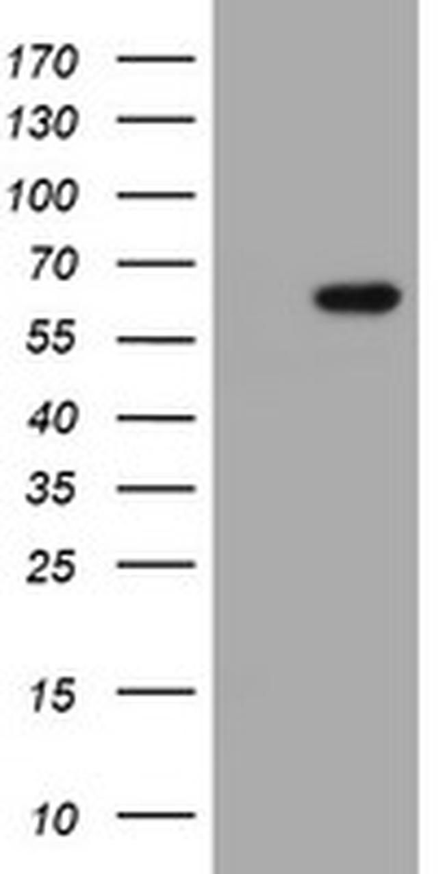 IPCEF1 Antibody in Western Blot (WB)