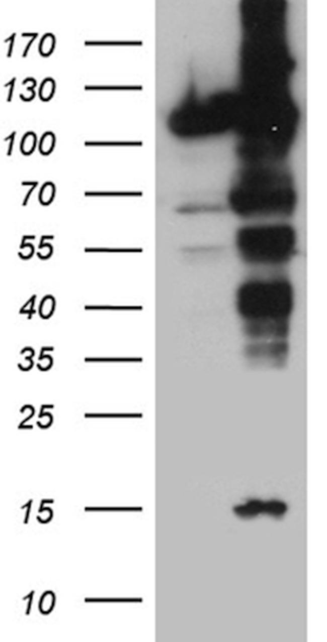 IPO5 Antibody in Western Blot (WB)