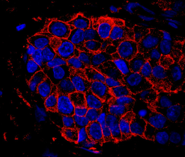 IQGAP1 Antibody in Immunohistochemistry (IHC)