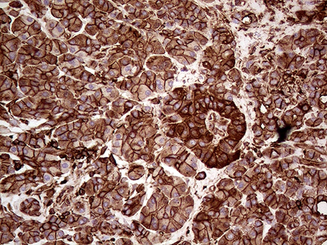 IQGAP1 Antibody in Immunohistochemistry (Paraffin) (IHC (P))