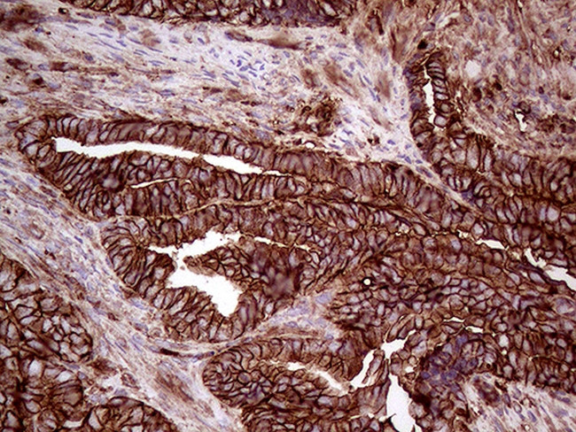 IQGAP1 Antibody in Immunohistochemistry (Paraffin) (IHC (P))