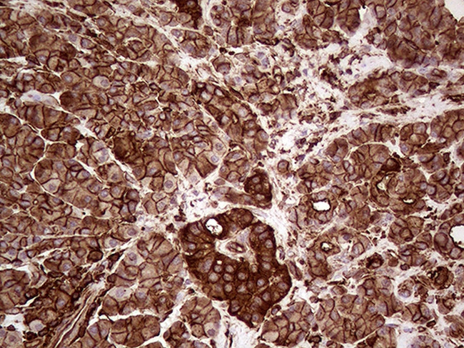 IQGAP1 Antibody in Immunohistochemistry (Paraffin) (IHC (P))