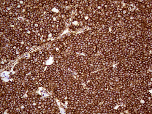 IQGAP1 Antibody in Immunohistochemistry (Paraffin) (IHC (P))