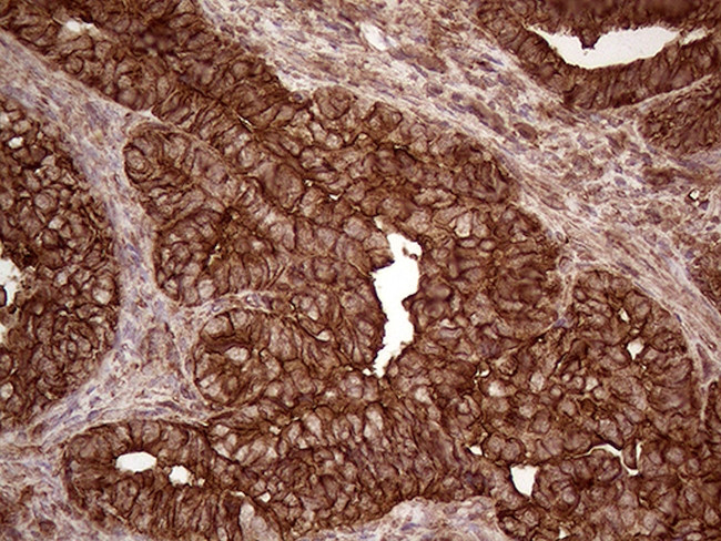 IQGAP1 Antibody in Immunohistochemistry (Paraffin) (IHC (P))