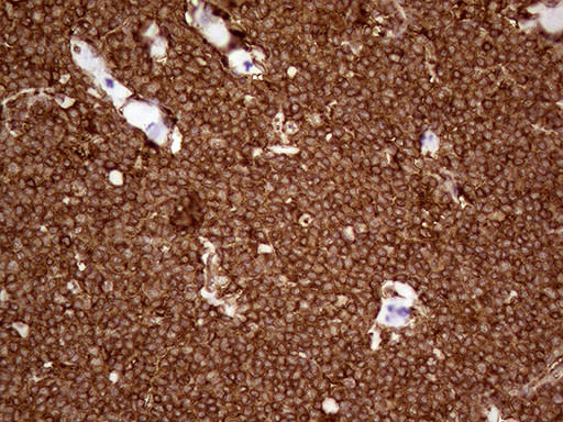 IQGAP1 Antibody in Immunohistochemistry (Paraffin) (IHC (P))