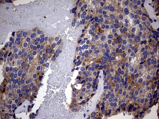 IRAK2 Antibody in Immunohistochemistry (Paraffin) (IHC (P))