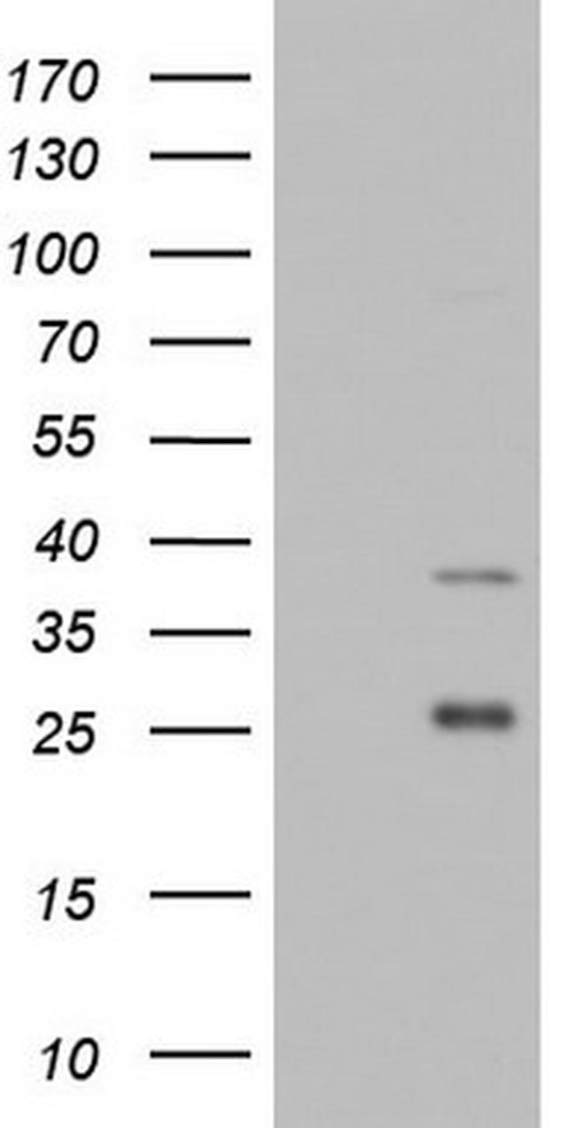 IRAK2 Antibody in Western Blot (WB)