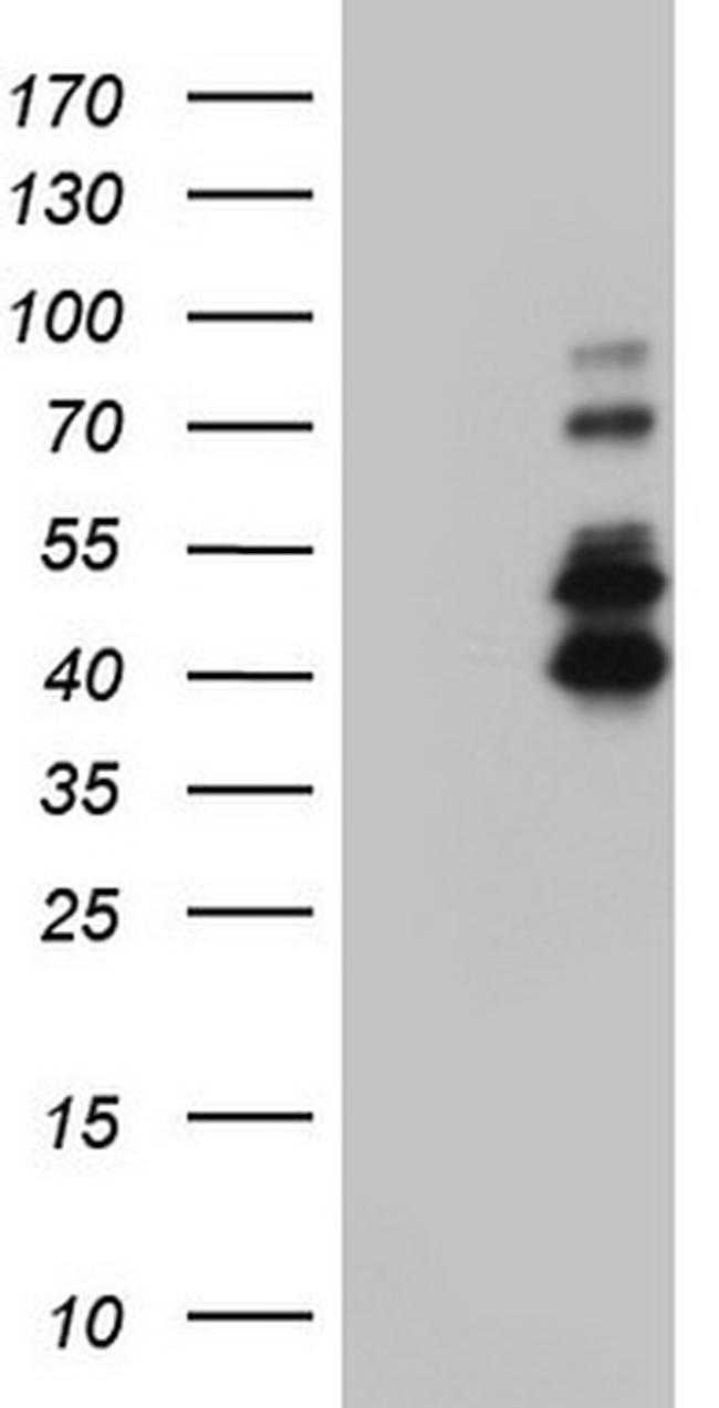 IRAK2 Antibody in Western Blot (WB)