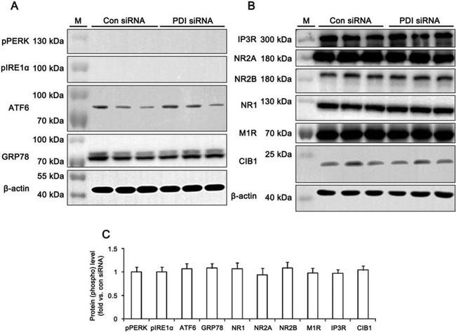 Phospho-IRE1 alpha (Ser724) Antibody in Western Blot (WB)