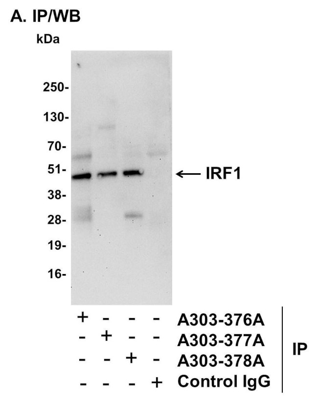 IRF1 Antibody in Immunoprecipitation (IP)