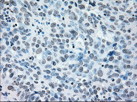 IRF3 Antibody in Immunohistochemistry (Paraffin) (IHC (P))