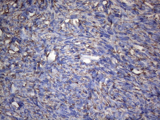 IRF3 Antibody in Immunohistochemistry (Paraffin) (IHC (P))