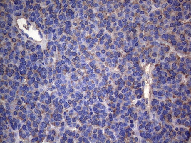 IRF3 Antibody in Immunohistochemistry (Paraffin) (IHC (P))